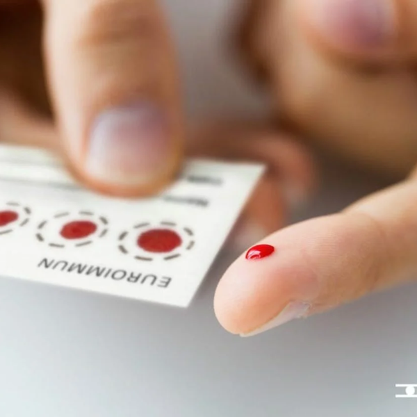 NAD+ Blood spot test